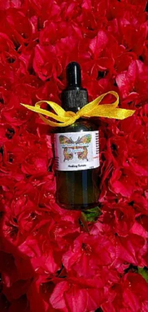 Healing Serum (Eczema, Psoriasis, Rosacea, Blemishes)